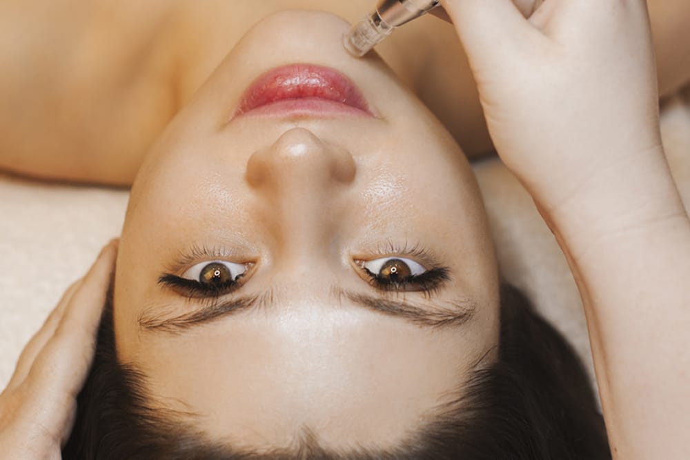 Microneedling